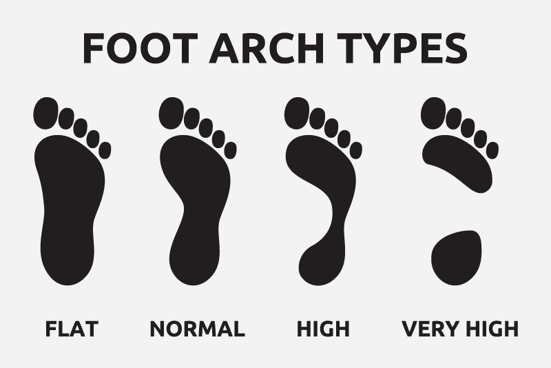 foot arch pain