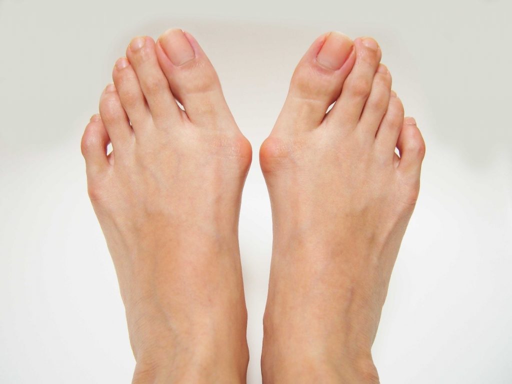 10 Common foot problems in children  Sanders Podiatry Linden Park,  Stirling, My Barker