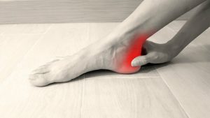 achilles tendinopathy