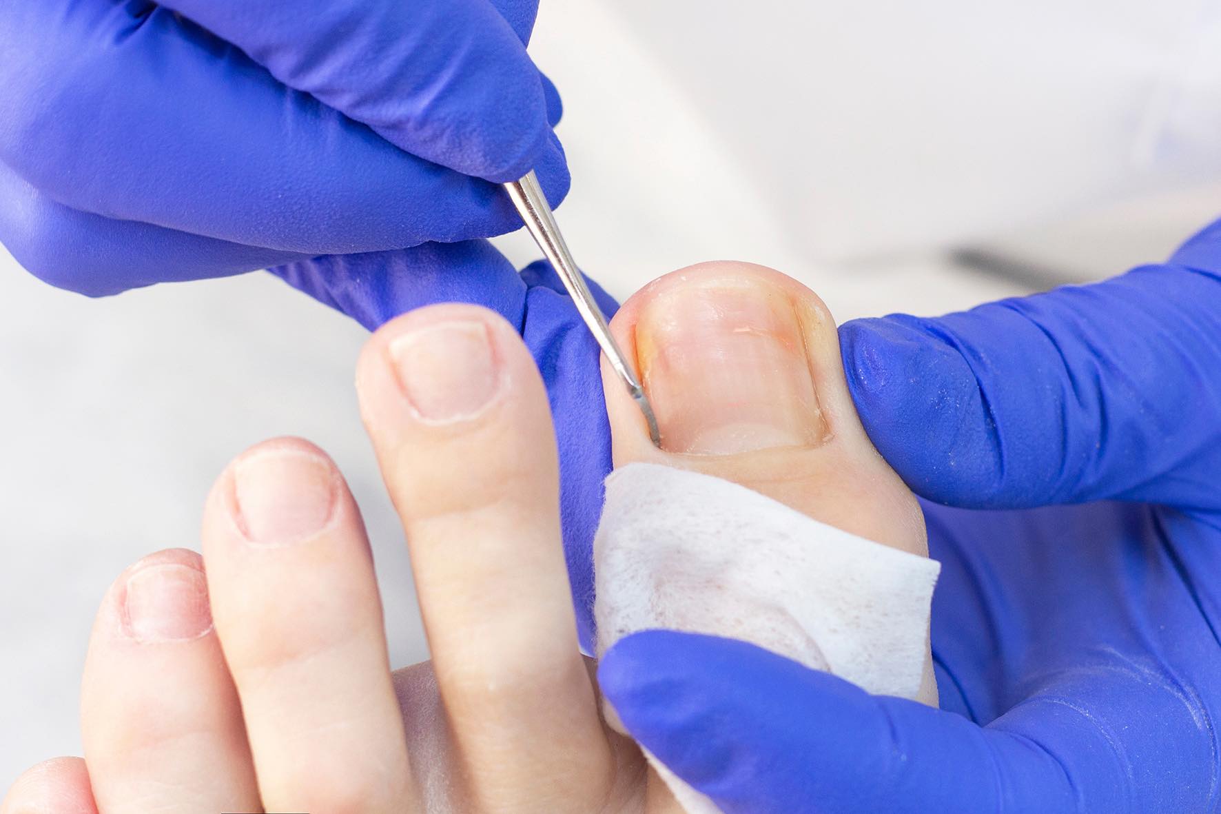 6 Self care Tips To Look After Your Toenails Sanders Podiatry